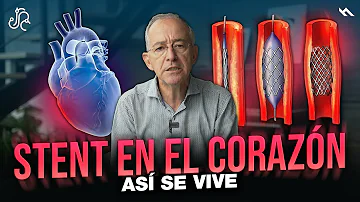 ¿Es frecuente tener dolor torácico después de un stent?