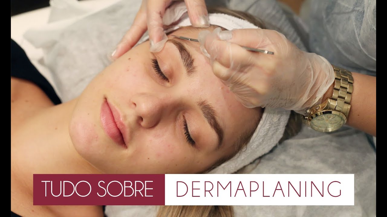 Tudo sobre: DERMAPLANING