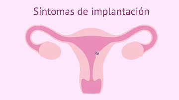 ¿En qué parte del estómago sientes la implantación?