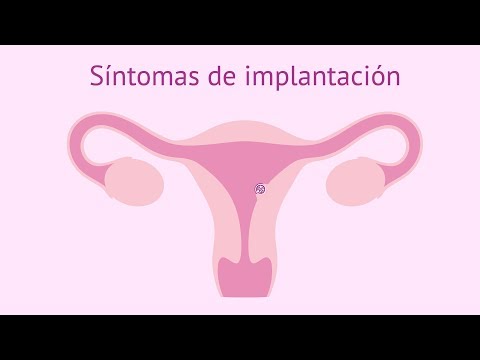 Vídeo: Com distingir els símptomes de la implantació dels símptomes de la síndrome premenstrual