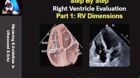 Step By Step: RV evaluation part 1:  measurements