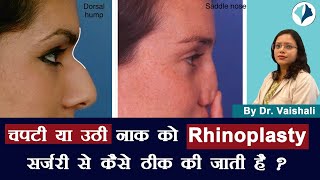 चपटी या  उठी नाक को Rhinoplasty Surgery से  कैसे ठीक की जाती हैं? | Dr Vaishali Shrivastava