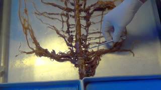 Plexus and selected Nerves