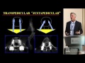 Thoracic Pedicle Screws - Michael Daubs, MD