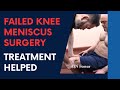 Failed knee meniscus surgery helped by dr suh