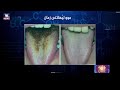 موولێهاتنی زمان موولێهاتنی زمان