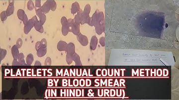 Platelets manual counting by blood smear explained easily in Urdu & Hindi.How platelet seen in slide