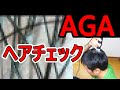 【2020年1月】AGA治療前のヘアチェック