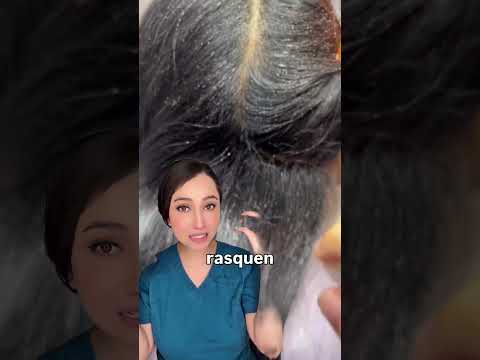 Piojos: Lo que debes de saber 👩🏻‍⚕️ #piojos #pediculosis #medicina #salud #drapauzúñiga