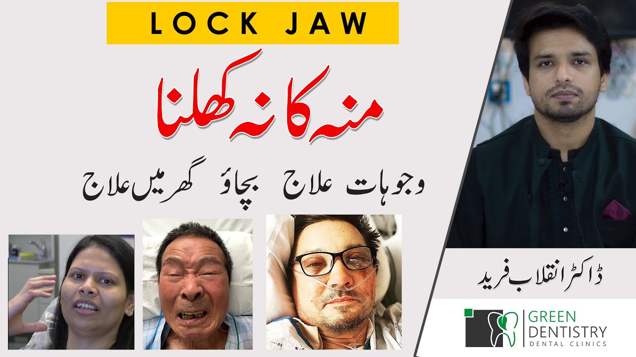 Lock Jaw Limited Mouth Opening منہ کا نہ کھلنا InqalabFareed