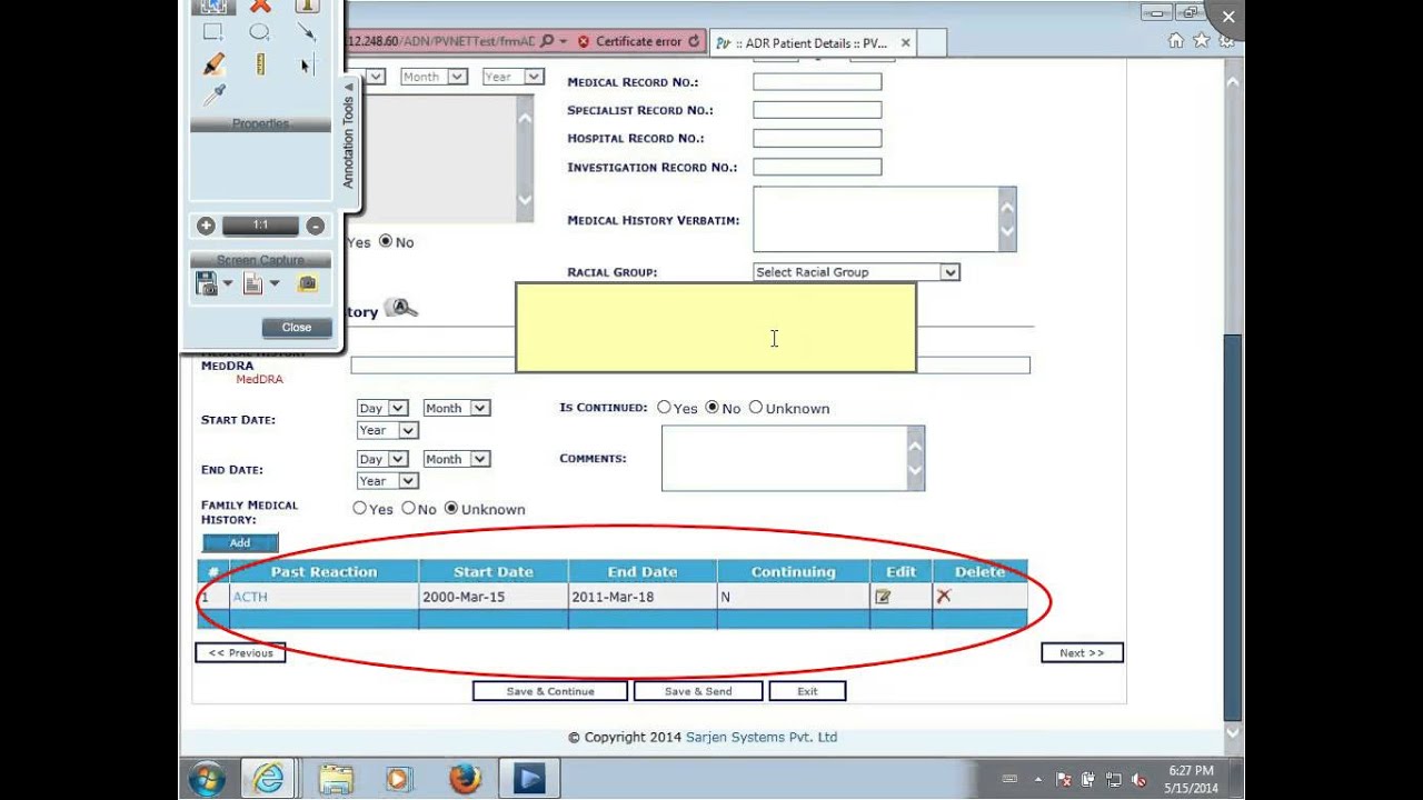5. Exécution d'un test BPT avec HP Sprinter
