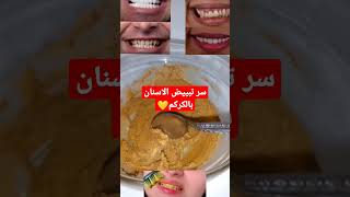 وصفه تبييض الاسنان بمعلقه وحده من الكركمجربوها سهله جدا