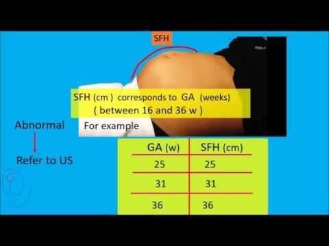 Video: Hoe de fundushoogte van de symphysis controleren?