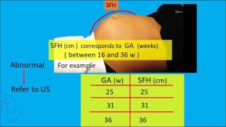 Symphysis Fundal Height ( SFH ) measurement