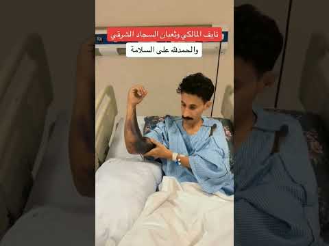 كشف نايف المالكي هاوي صيد الثعابين تفاصيل تعرضه للدغه ثعبان سام اكسبلور  تيك توك 