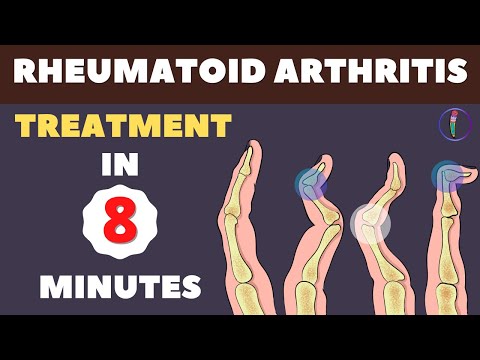 Rheumatoid Arthritis Treatment - New Medicines and