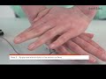 センサーメンブレンの交換方法