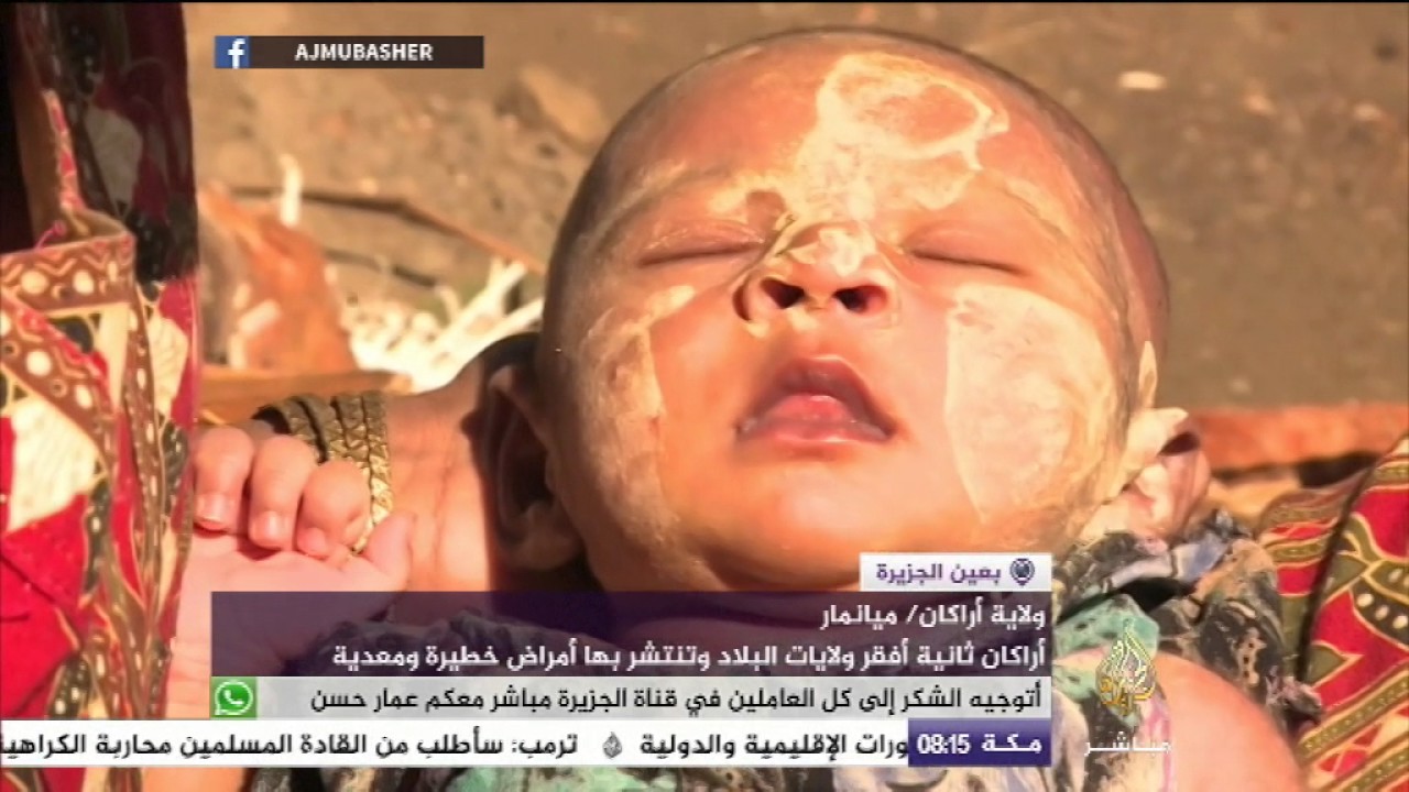 قرى الروهينغيا تشكو انتشار الأمراض وسوء الرعاية الصحية