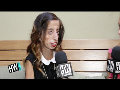 Lizzie Velasquez Shares Inspiring Story Anti Bullying Advice A Brave