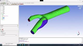 Basic Meshing in IcemCFD - Carotid Tet Mesh with Inflation Layer