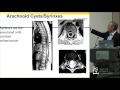 Spinal Cord Tumors - Daniel M. Sciubba, MD