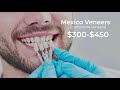 Veneers in Mexico vs USA