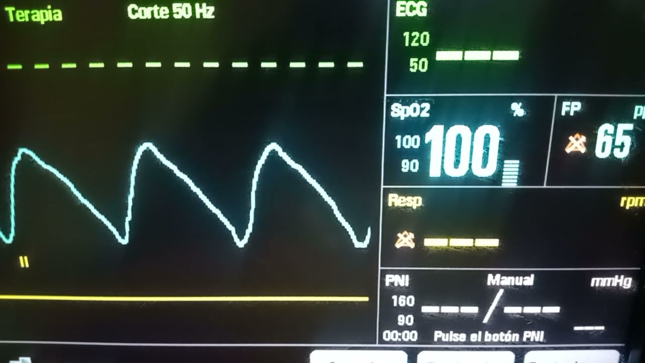 Sonido de monitor cardiaco / heart monitor sound