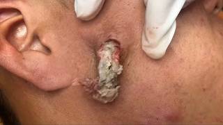 𝑨𝒄𝒉𝒊𝒆𝒗𝒆 𝑰𝒏𝒏𝒆𝒓 𝑷𝒆𝒂𝒄𝒆 𝑾𝒊𝒕𝒉 𝑻𝒉𝒆𝒔𝒆 𝑭𝒂𝒄𝒊𝒂𝒍 𝑪𝒍𝒆𝒂𝒏𝒔𝒊𝒏𝒈 𝑴𝒆𝒕𝒉𝒐𝒅𝒔 #500969