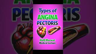 Types of Angina Pectoris | Stable vs Unstable vs Variant Angina ❤️