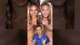 What plastic surgery has Beyonce had? #shorts Resimi