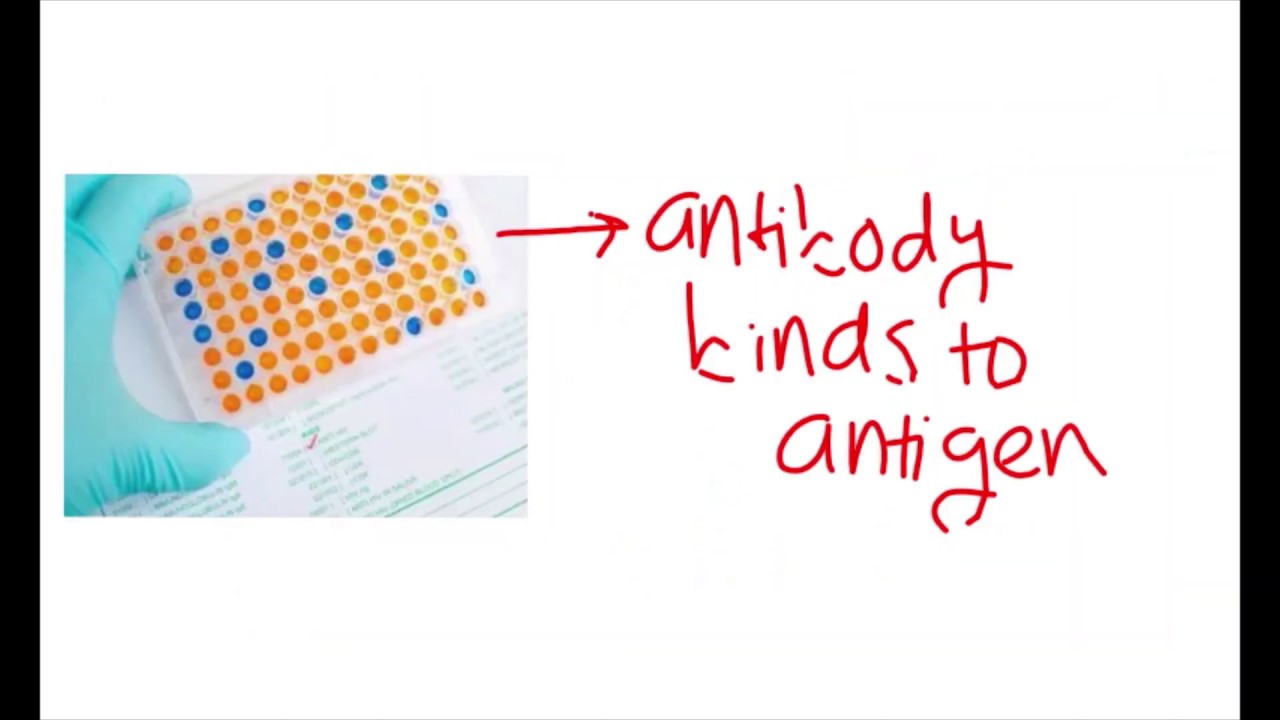 Application of Statistics - Practice Problem - YouTube