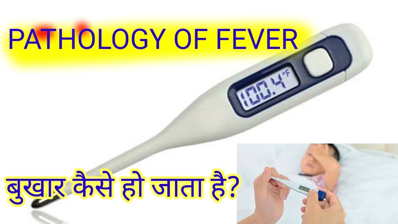 fever !! pathology of fever !! causes, !! बुखार में शरीर का तापमान