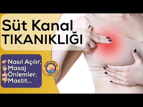 Süt Kanal Tıkanıklığı (Nasıl Açılır, Masaj, Önlem, Nedenler...)