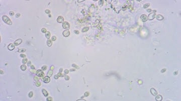 Video of Yeast Cells under Inverted Microscope