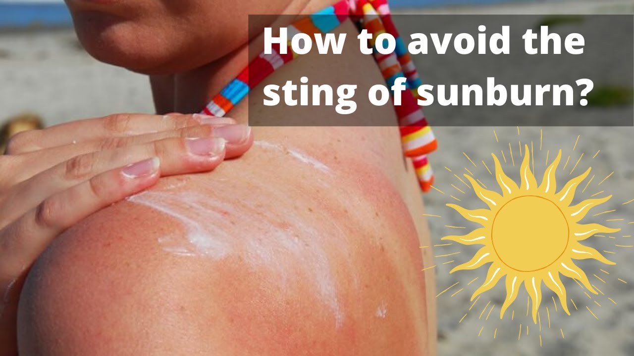 How to avoid the sting of sunburn? YouTube