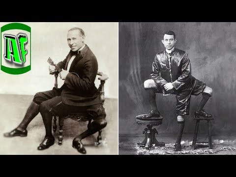 კაცი 3 ფეხით , რეალური ისტორია