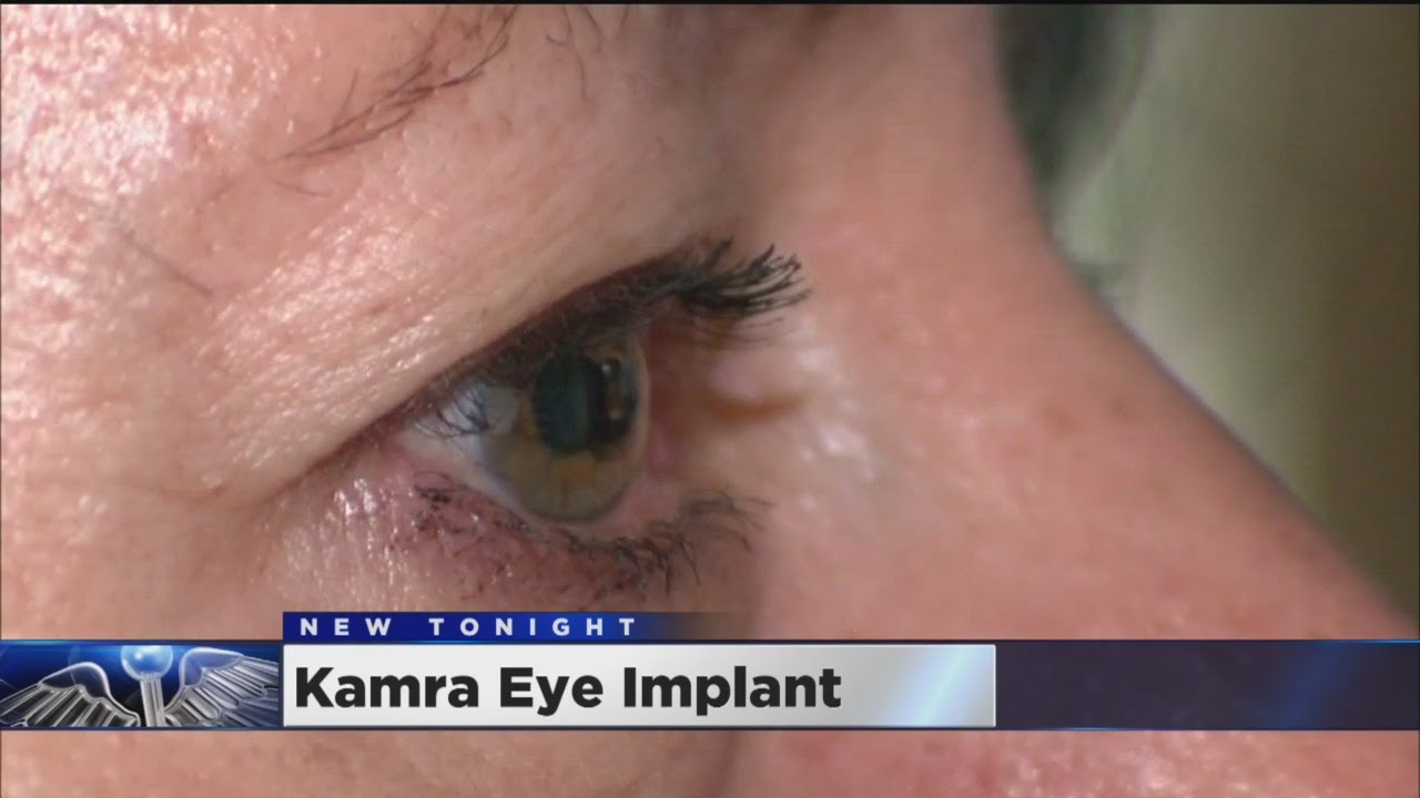 New Procedure Could Help Aging Boomers Ditch Glasses