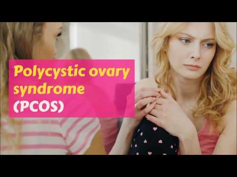 How PCOS can affect Fertility -  PCOS causes & symptoms
