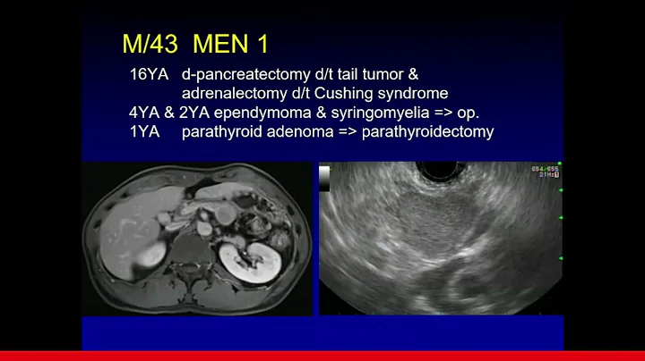 13  Therapeutic EUS in 2021  Dr  Dong Wang Seo - DayDayNews