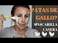 PATAS DE GALLO/ MASCARILLA CASERA-Adriana Vieira