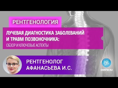 Рентгенолог Афанасьева И.С.: Лучевая диагностика заболеваний и травм позвоночника