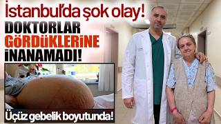 Karnındaki Şişliği Kabızlık Sandı, 22 Kiloluk Dev Tümör Çıktı