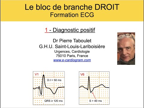 Vidéo: Bloc Cardiaque Ou Retard De Conduction (ensemble Droit) Chez Les Chiens