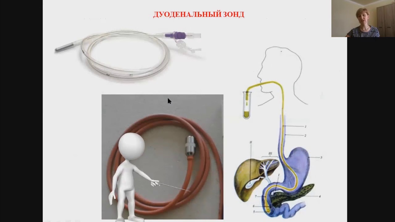 Что делает зонд. Фракционное желудочное зондирование. Зонд для зондирования желчного пузыря. Дуоденальное зондирование желчного пузыря. Дуоденальное зондирование алгоритм выполнения.