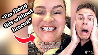 Can Old Retainers Fix Your Crooked Teeth?