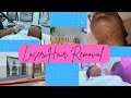 My Laser Hair Removal Journey VLOG | Skin Care Prep | PCOS | Hirsutism