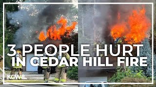 Fire burns 2 homes in Cedar Hills area, injures 3 people