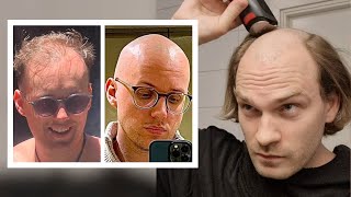 BALDING Men NO BEARD First Time SHAVING HEAD BALD