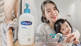 Lotion na Effective sa Peklat ng Bata  Totoo ba? | Product Review