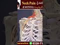 Neck Pain & cervical radiculopathy treatment #backpain #kneepain #neckpain